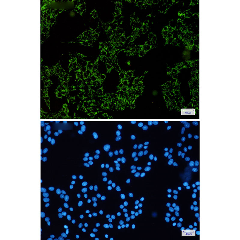 SGSM1 Rabbit mAb