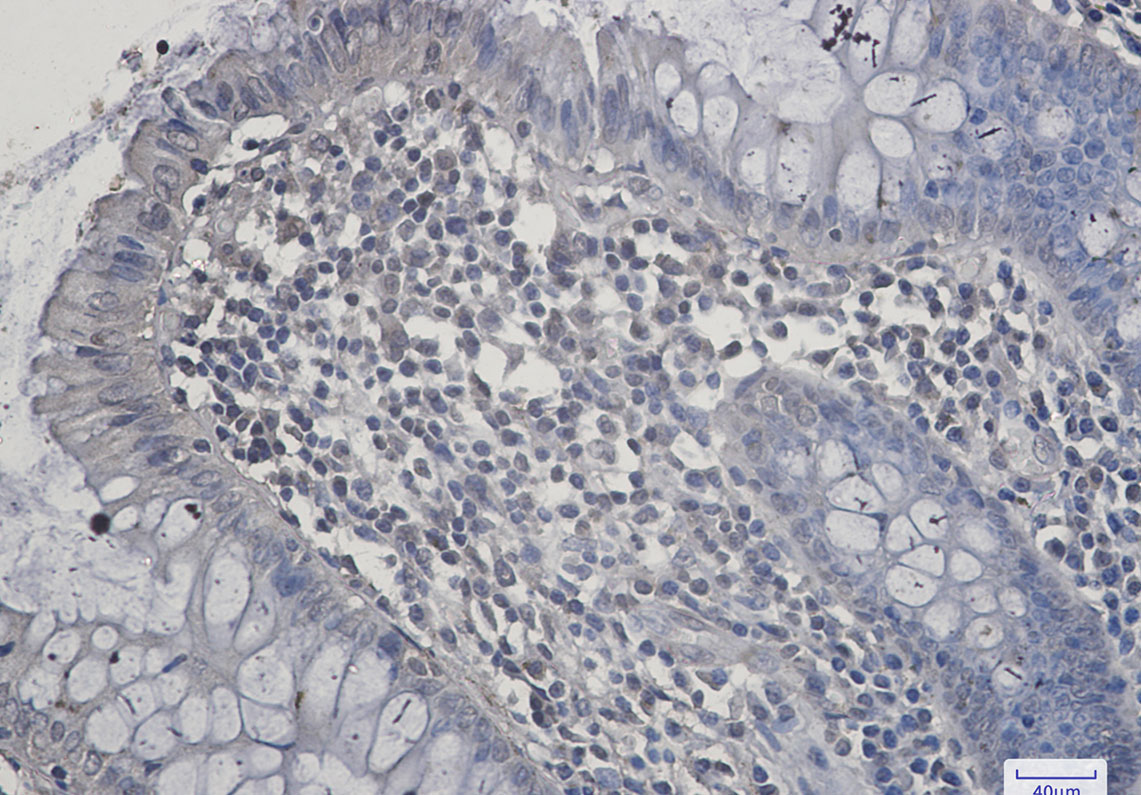 SIRT2 Rabbit mAb