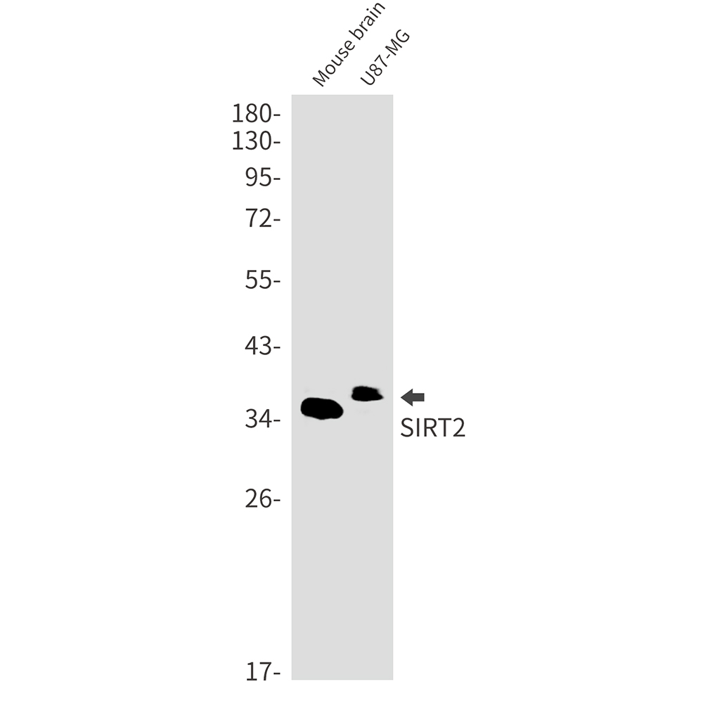 SIRT2 Rabbit mAb