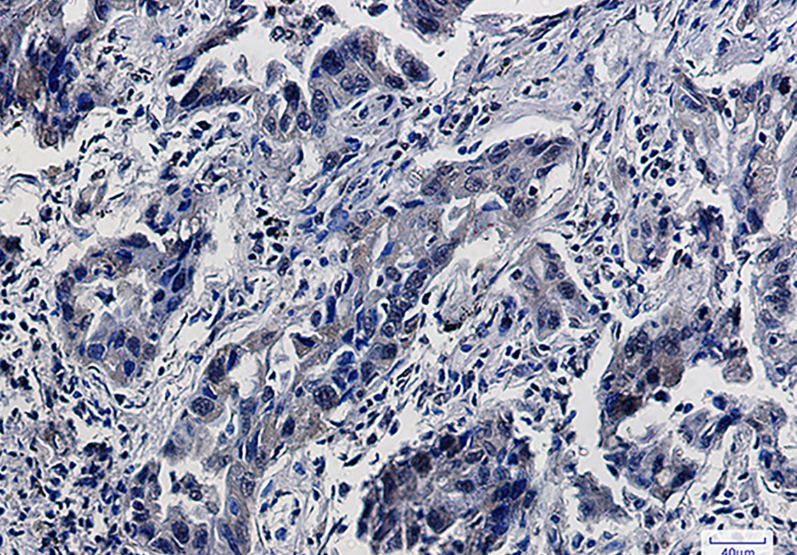 Smad5 Rabbit mAb