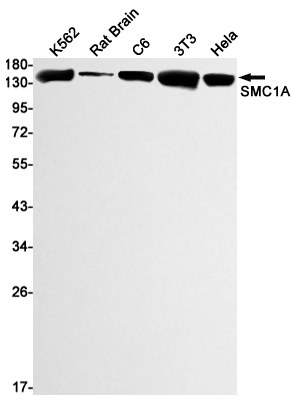 SMC1A Rabbit mAb