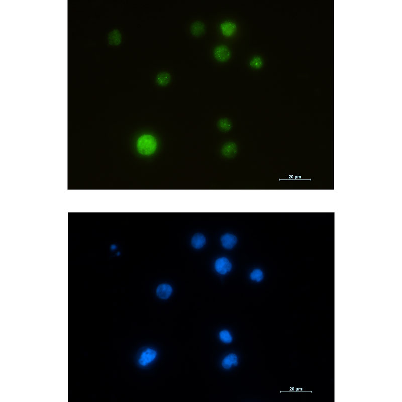 SMARCA5 Rabbit mAb