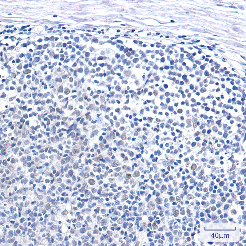 SMARCB1 Rabbit mAb