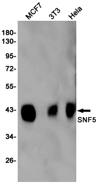 SMARCB1 Rabbit mAb