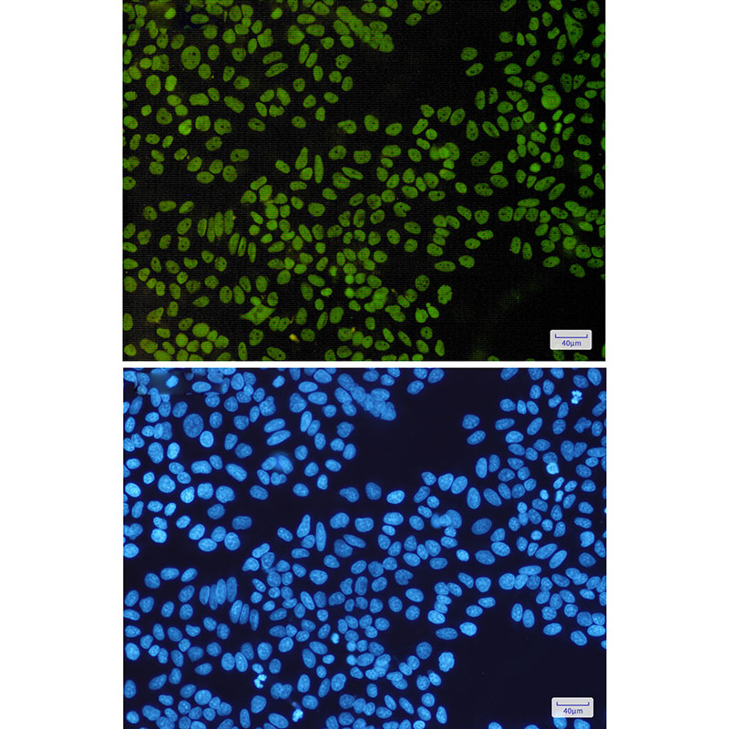 SMARCB1 Rabbit mAb