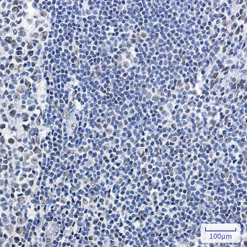 SMARCB1 Rabbit mAb
