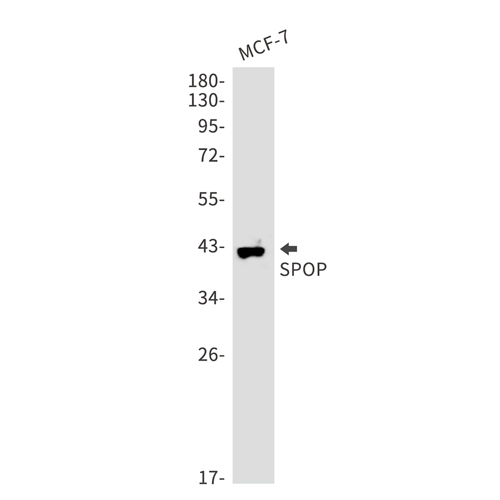 SPOP Rabbit mAb