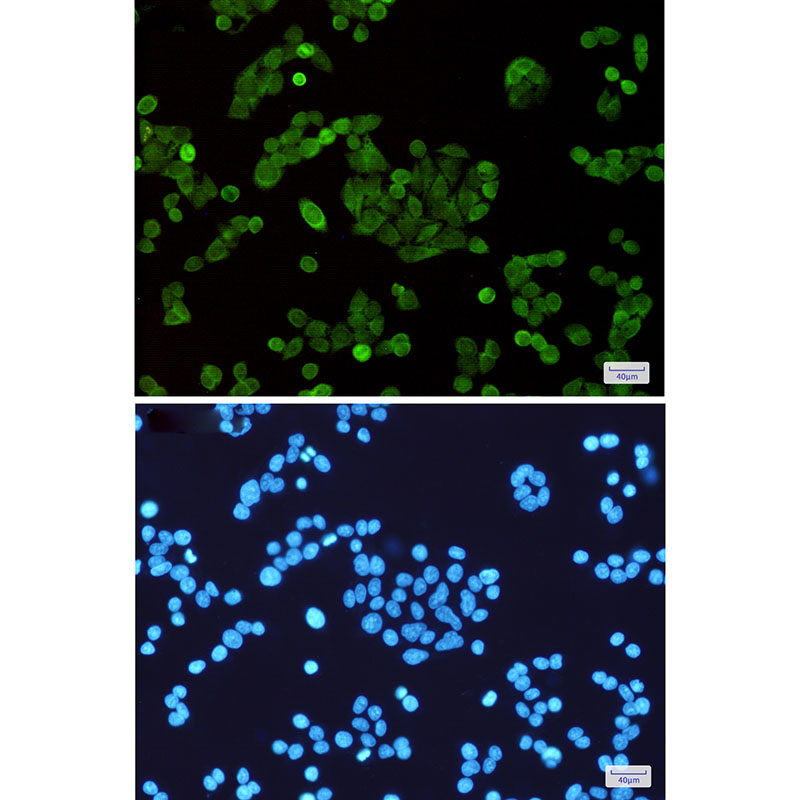 STAT5 Rabbit mAb