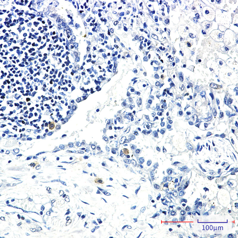 STK3 Rabbit mAb