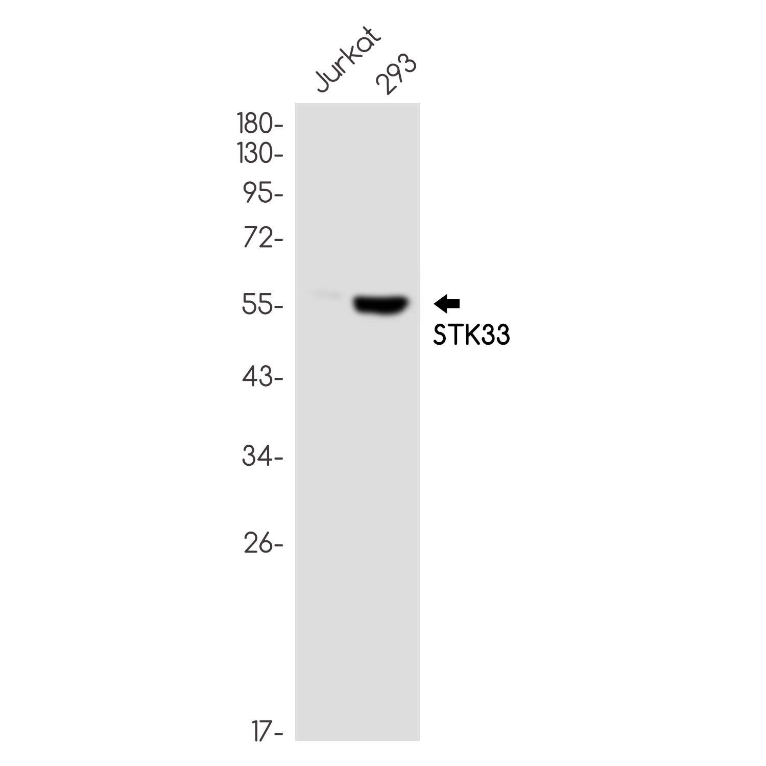 STK33 Rabbit mAb