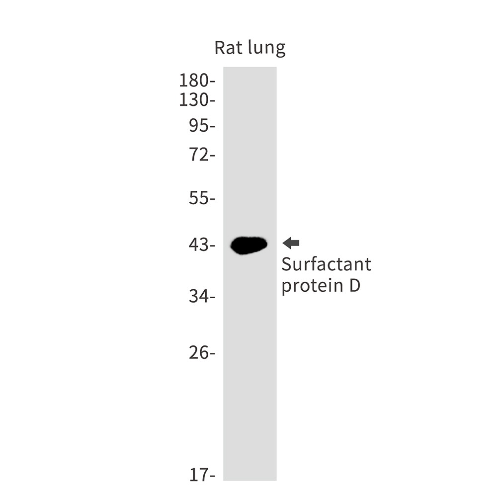 Pulmonary Surfactant Associated Protein D Rabbit mAb