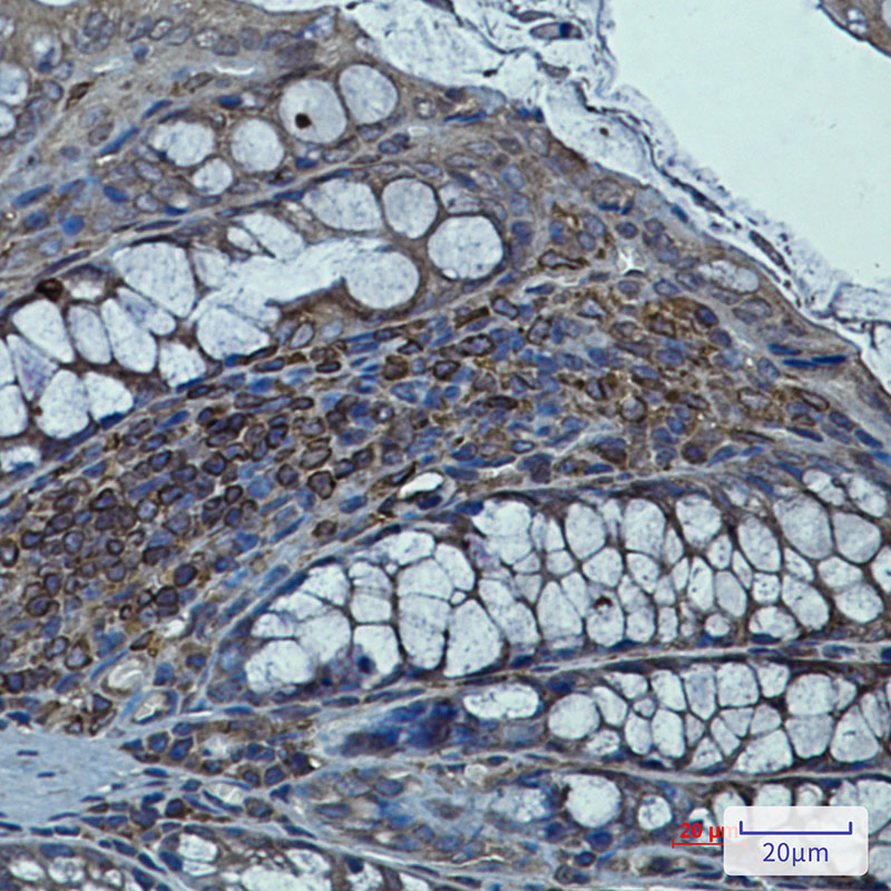 Syntrophin alpha 1 Rabbit mAb