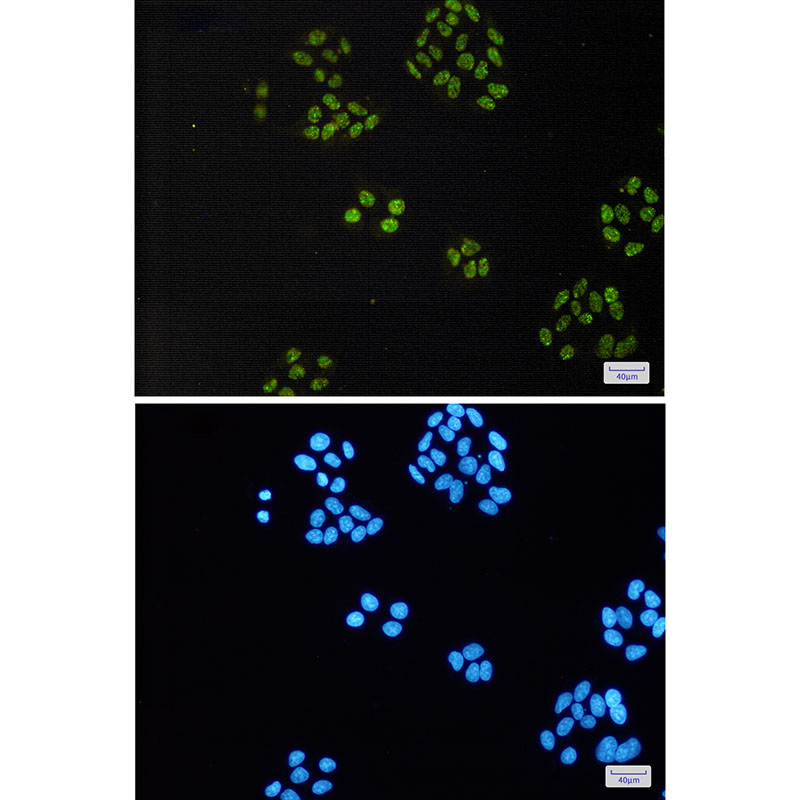TAF15 Rabbit mAb