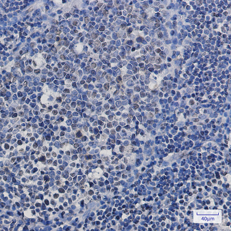 TAF15 Rabbit mAb