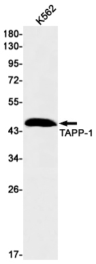 PLEKHA1 Rabbit mAb