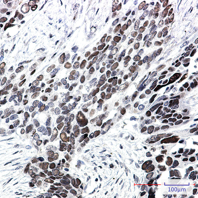 Transcription Factor 7 Like 2 Rabbit mAb