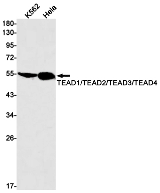 Transcriptional Enhancer Factor TEF Rabbit mAb