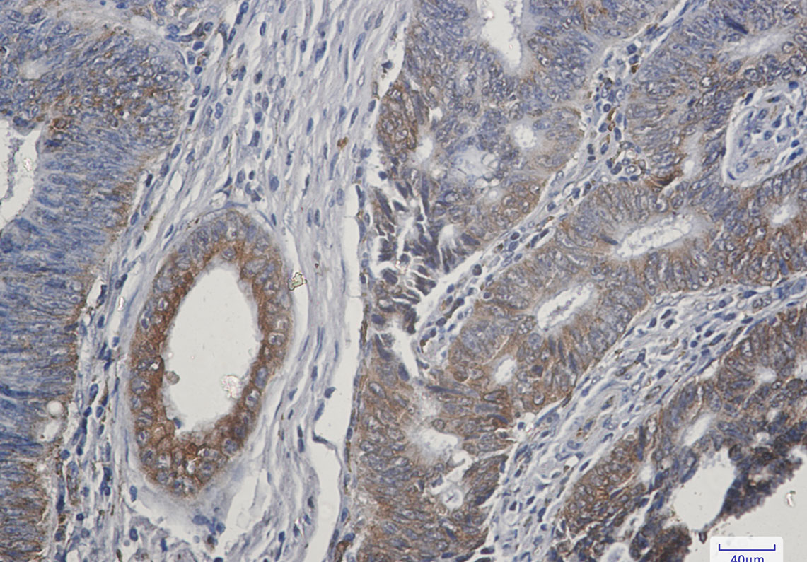 TGF alpha Rabbit mAb