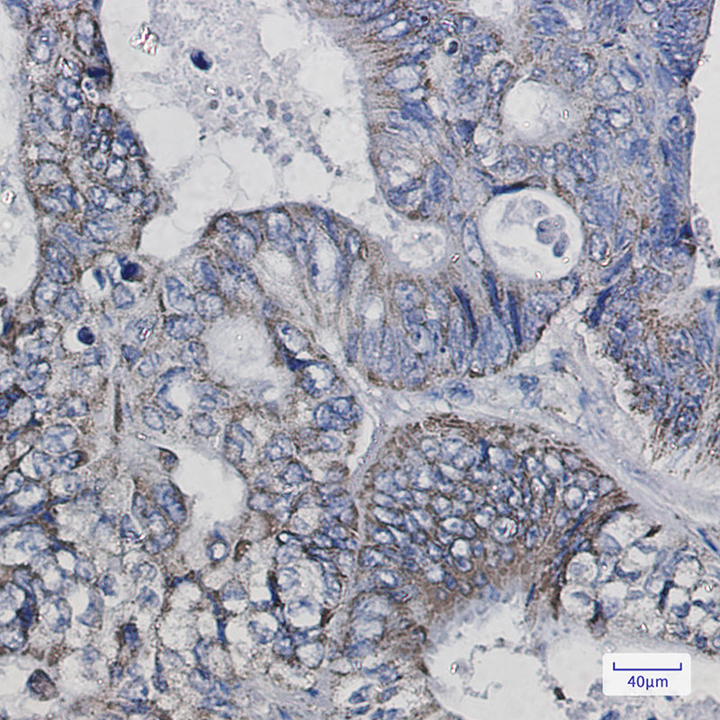 Thioredoxin 2 Rabbit mAb