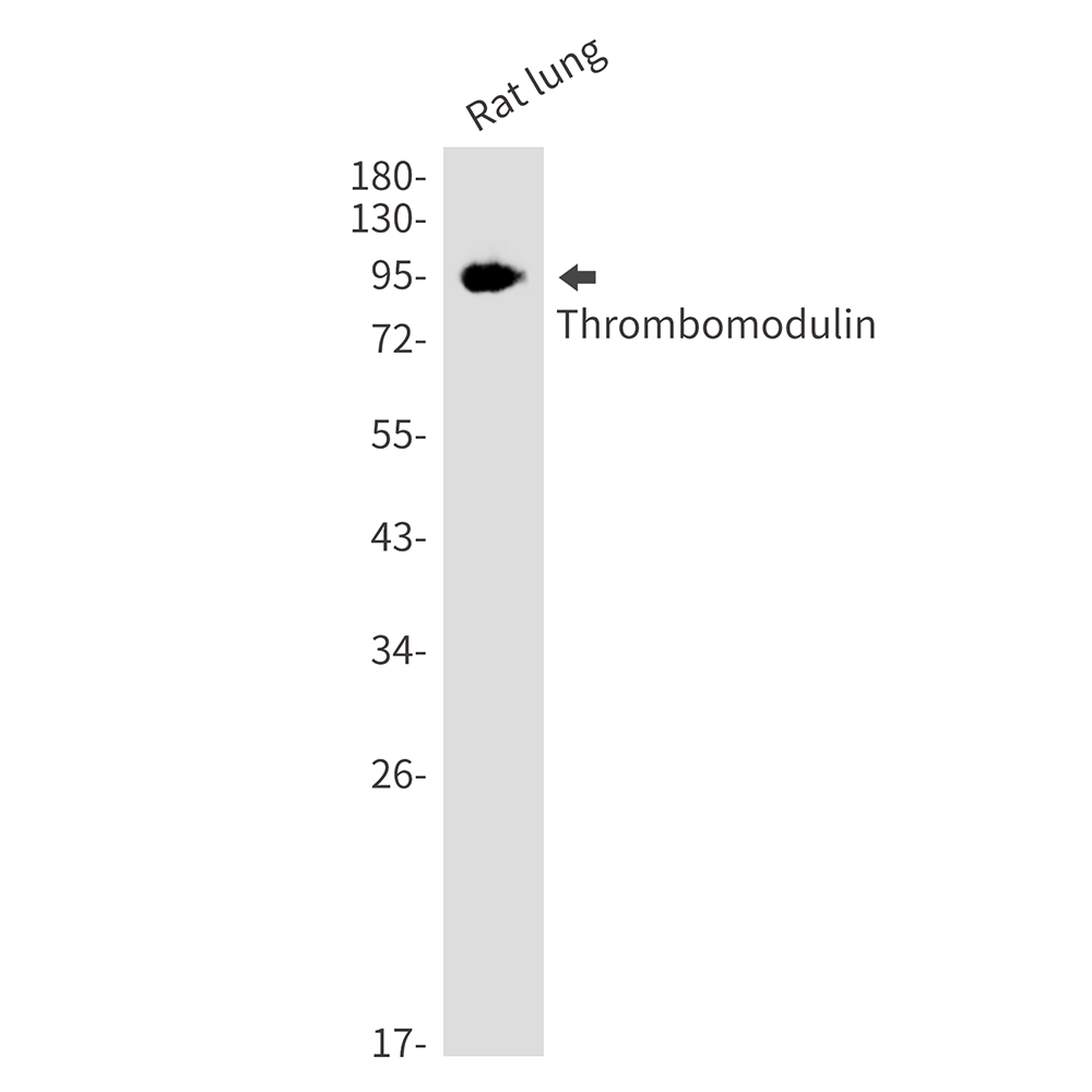 Thrombomodulin Rabbit mAb