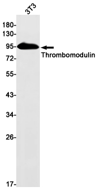 Thrombomodulin Rabbit mAb