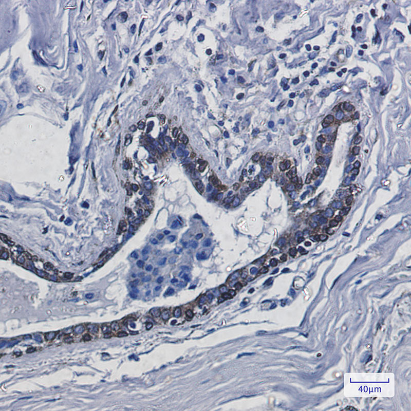 Transmembrane Protein 43 Rabbit mAb