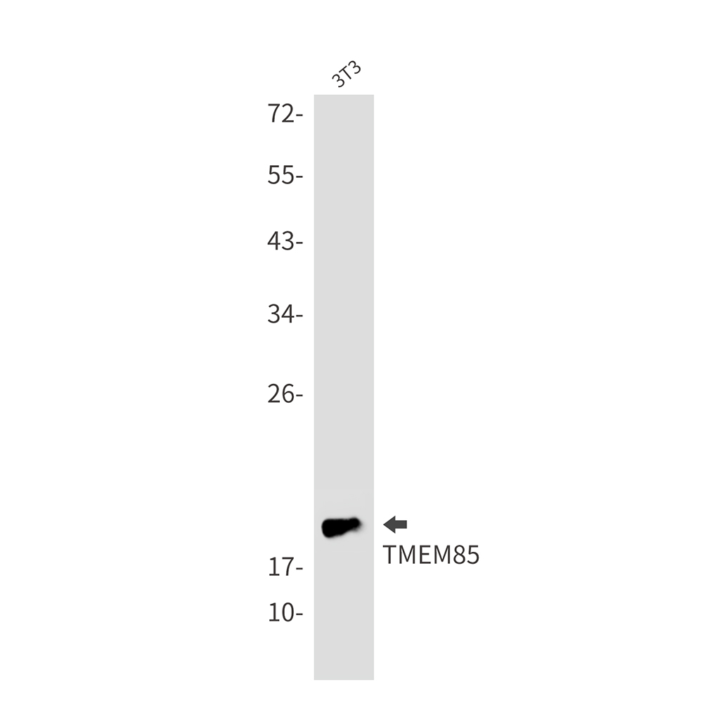 Transmembrane Protein 85 Rabbit mAb