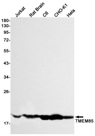 Transmembrane Protein 85 Rabbit mAb