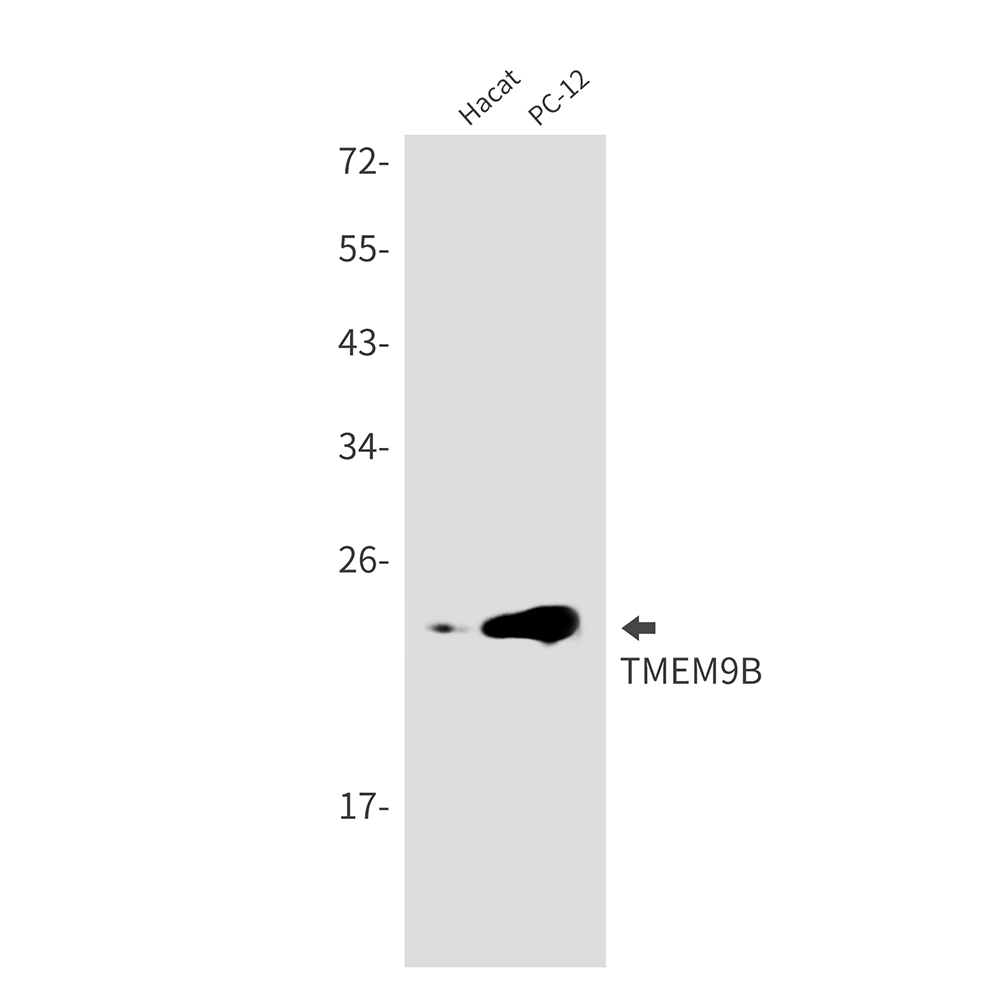 Transmembrane Protein 9B Rabbit mAb
