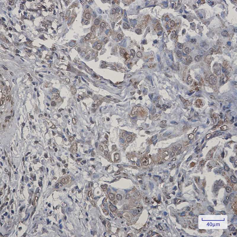 TNFAIP3 Rabbit mAb