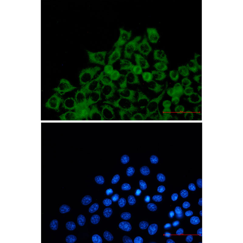 TOMM20 Rabbit mAb