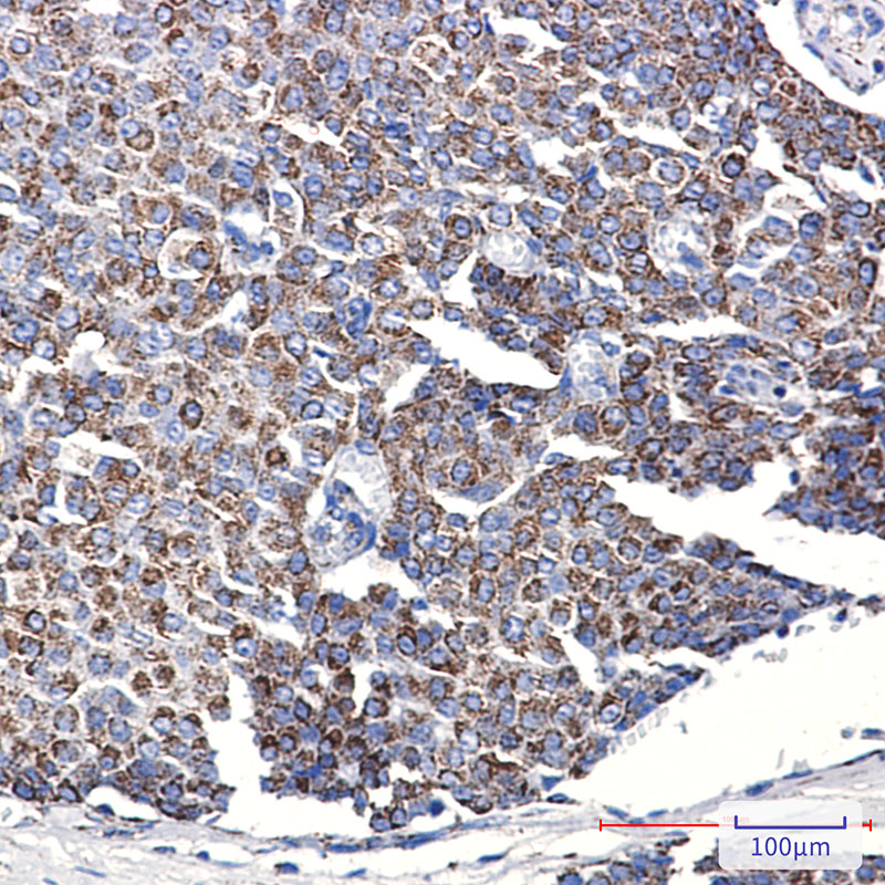 TOMM20 Rabbit mAb