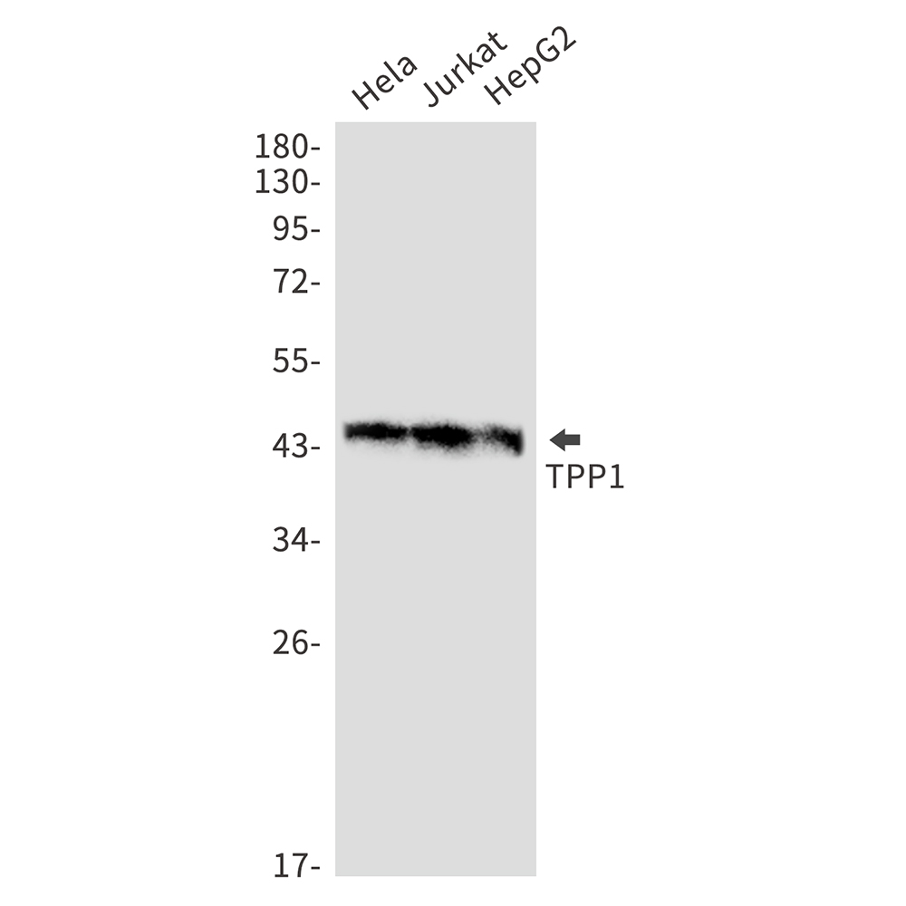 TPP1 Rabbit mAb