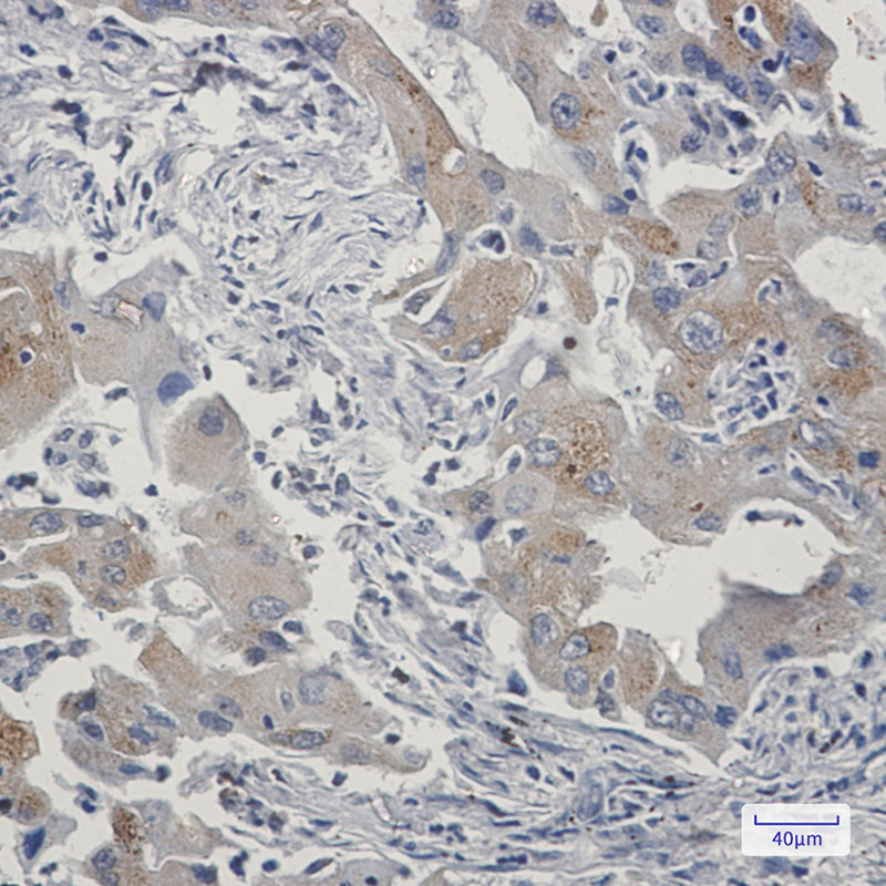 TAX1BP1 Rabbit mAb