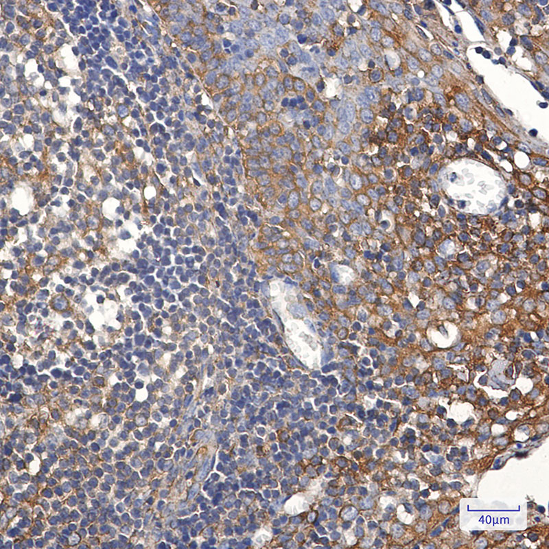 TFG Rabbit mAb