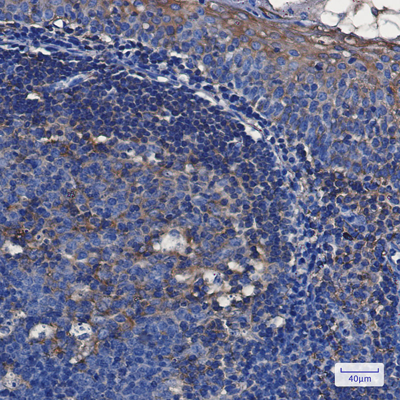 TFG Rabbit mAb
