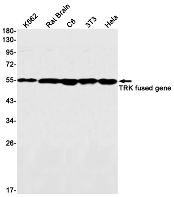 TFG Rabbit mAb
