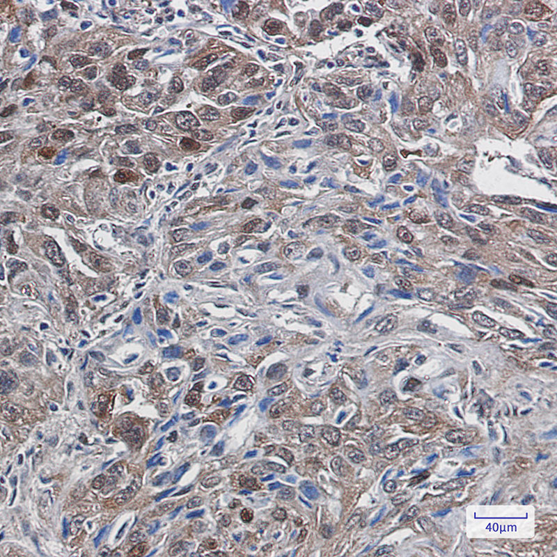 Thioredoxin Reductase 1 Rabbit mAb