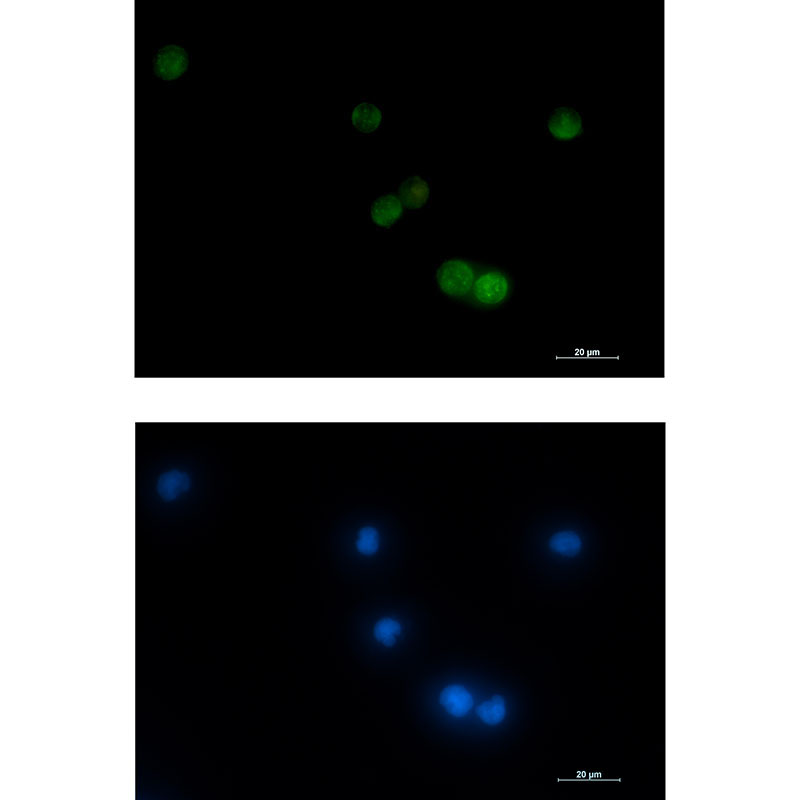VAMP2 Rabbit mAb