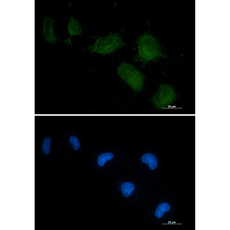 Vitamin D Binding Protein Rabbit mAb
