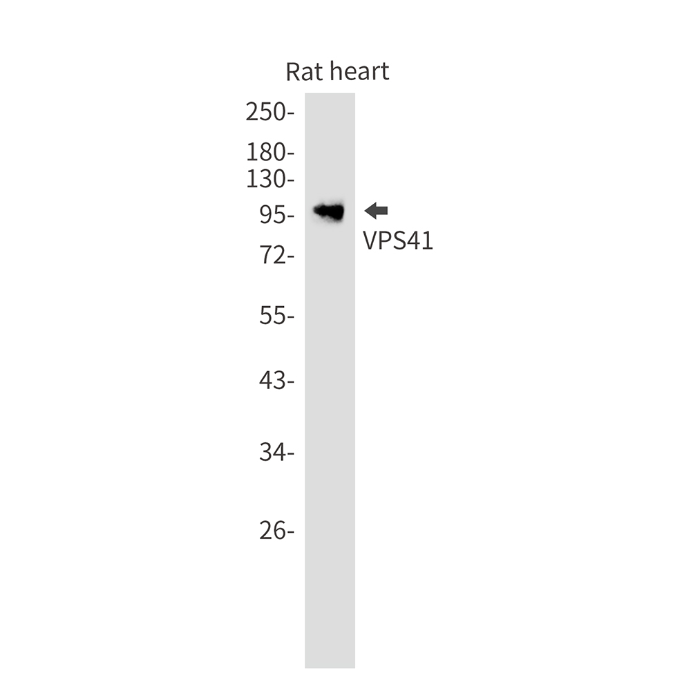 VPS41 Rabbit mAb