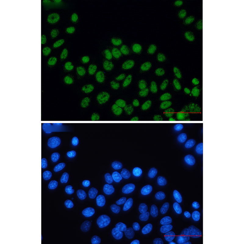 XPD Rabbit mAb