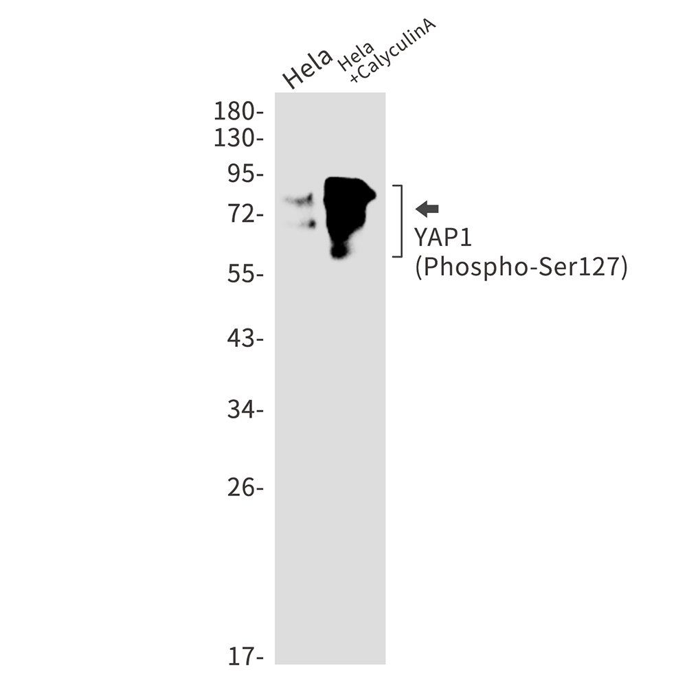 Phospho-YAP1 (Ser127) Rabbit mAb