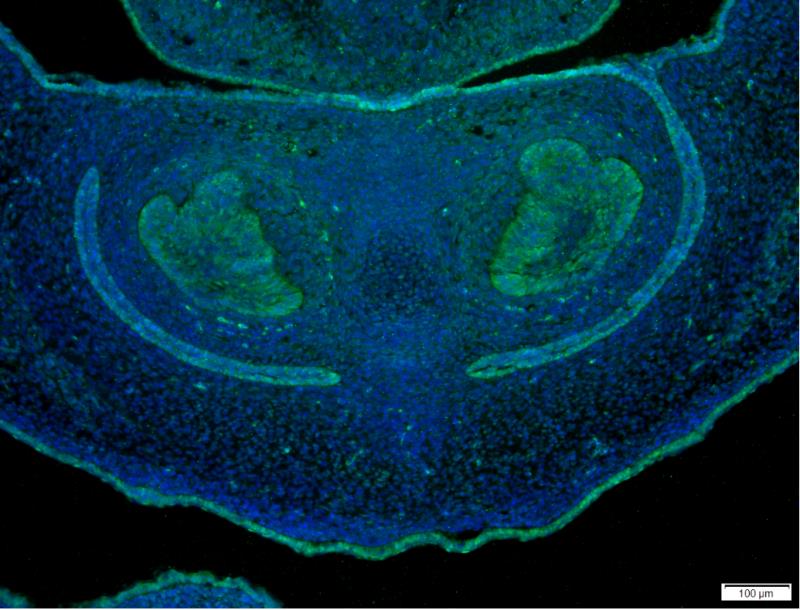 YAP1 Rabbit mAb