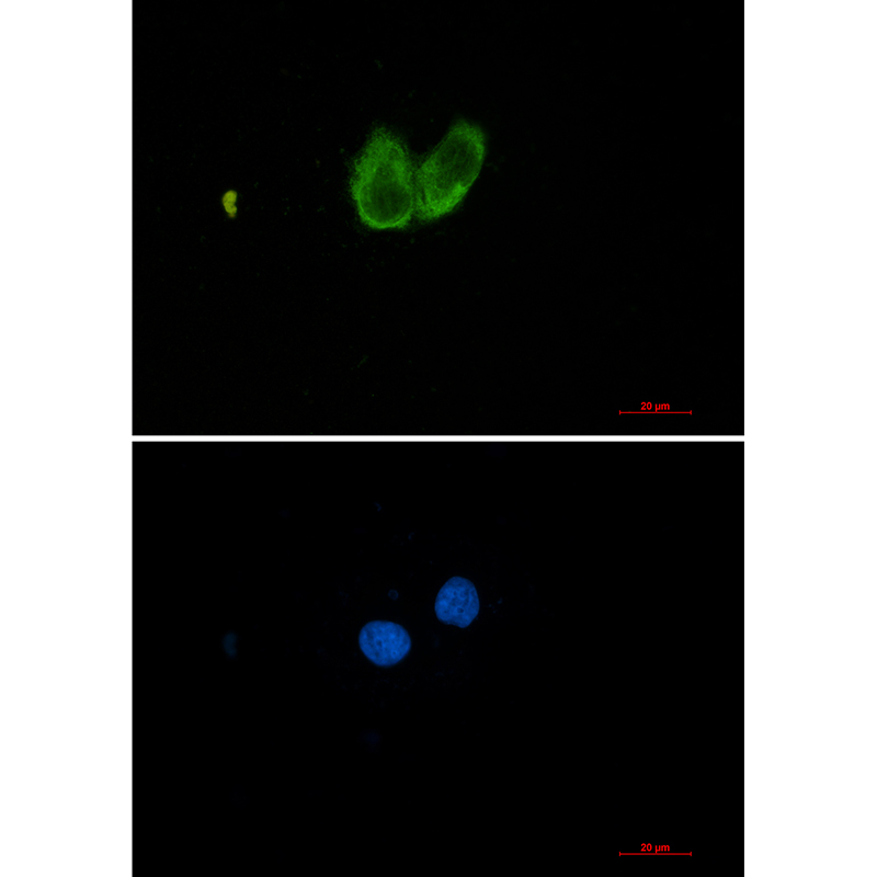 ZYX Rabbit mAb