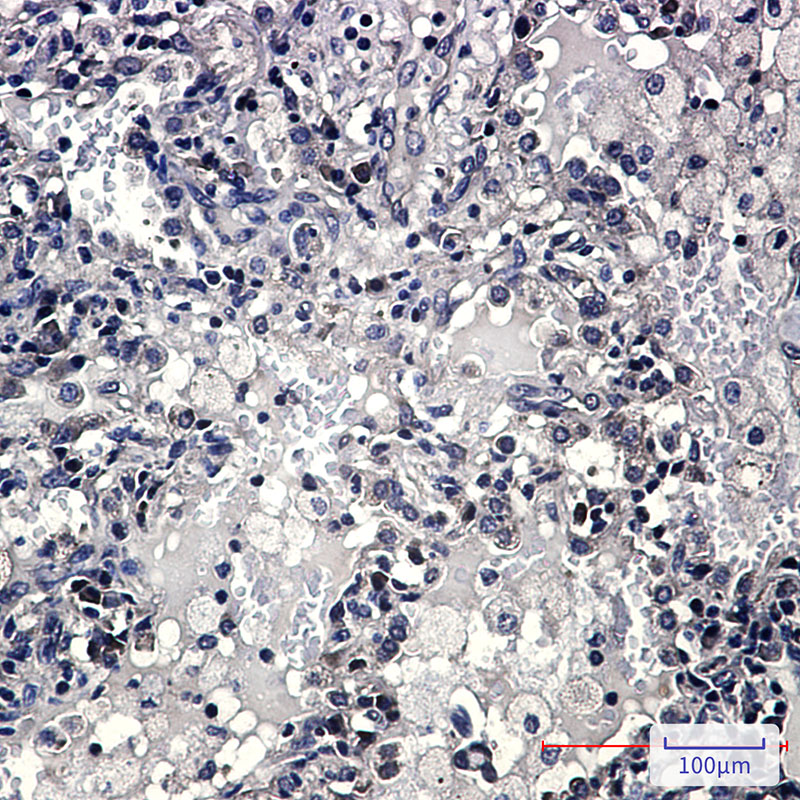 ZYX Rabbit mAb