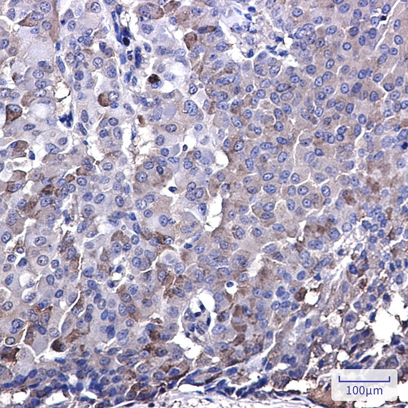 IRF7 Rabbit mAb