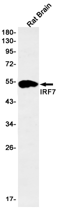 IRF7 Rabbit mAb