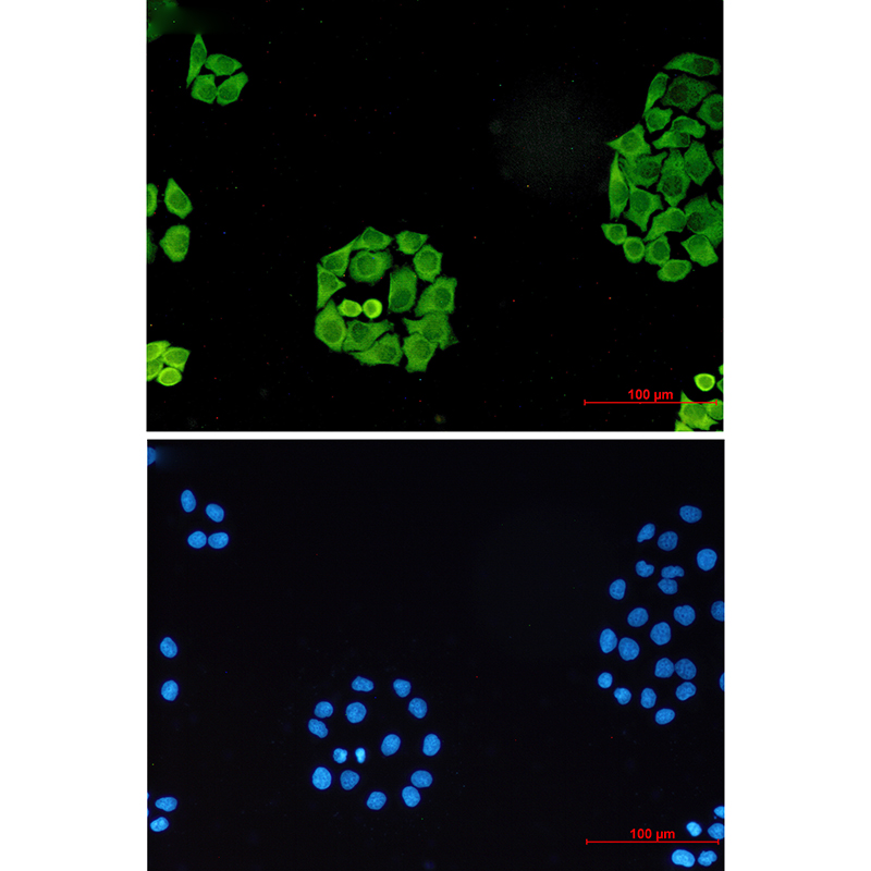 Surfeit Locus Protein 4 Rabbit mAb