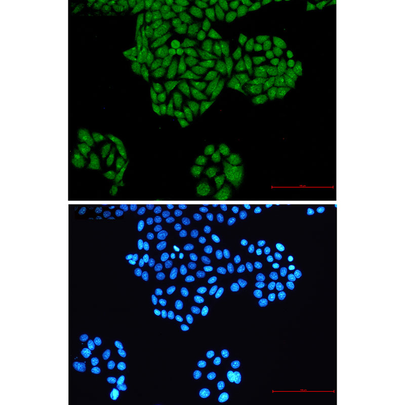 RYK Rabbit mAb